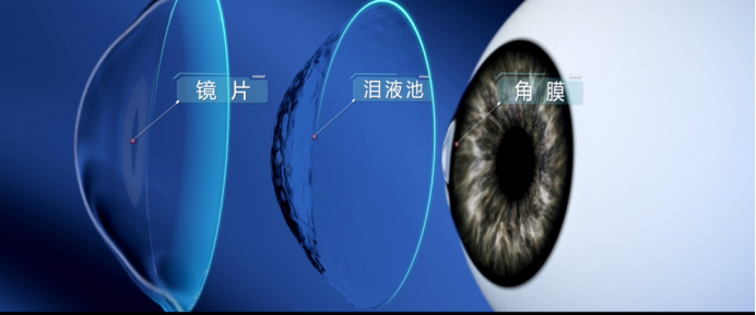 
			林江院長(zhǎng)赴長(zhǎng)沙見(jiàn)證愛(ài)爾眼科鞏膜鏡技術(shù)診療門(mén)診啟動(dòng)儀式
		(圖2)