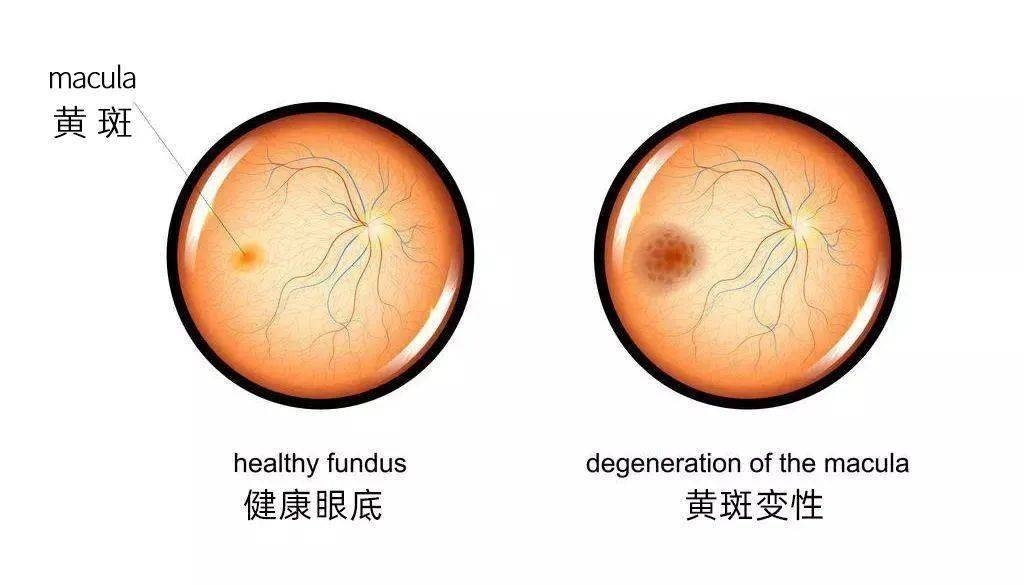 葉黃素對眼睛真的有效嗎？一文讀懂它的功效與作用(圖3)
