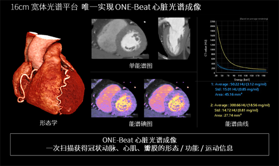 登陸中國(guó)，首款16cm光譜成像、超高清寬體CT國(guó)產(chǎn)上市(圖3)
