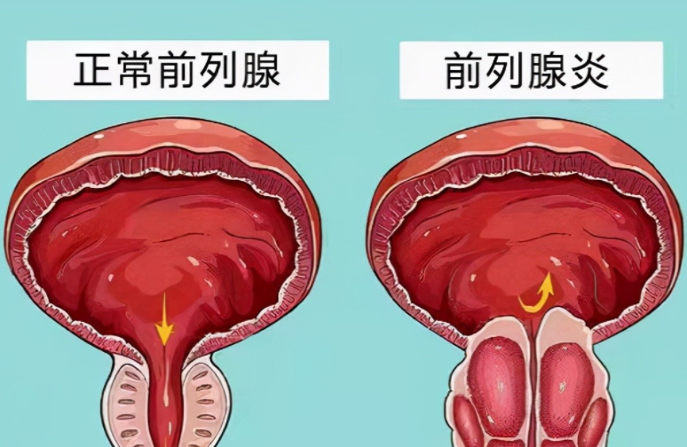 贛州現(xiàn)代泌尿?qū)？漆t(yī)院好不好？專業(yè)醫(yī)療，呵護(hù)您的健康